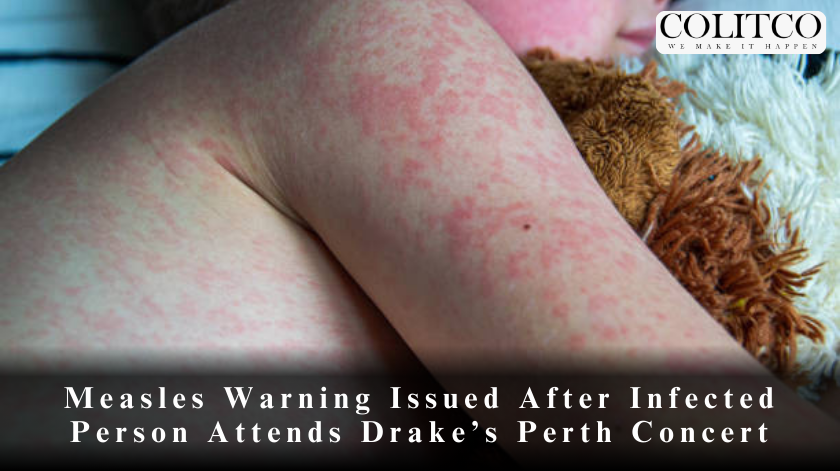Measles Warning Issued After Infected Person Attends Drake’s Perth Concert