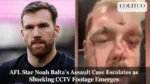 AFL Star Noah Balta’s Assault Case Escalates as Shocking CCTV Footage Emerges