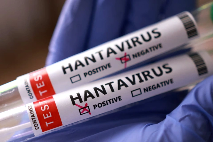 Hantavirus test samples prepared for laboratory analysis and infectious disease research.