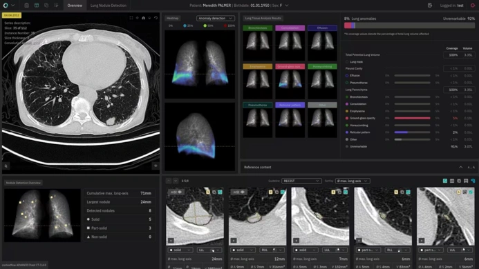 Contextflow’s AI-powered lung imaging platform for lung nodule detection, advanced thoracic image analysis, and respiratory disease assessment.